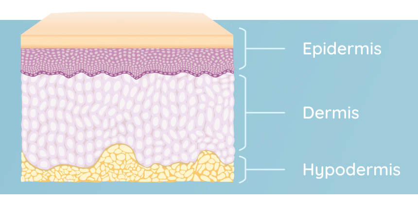 Graphic of skin layers