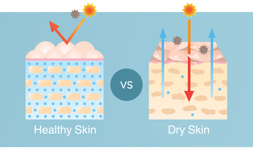 Graphic showcasing healthy skin vs dry skin 